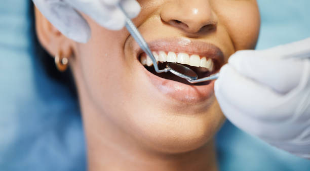 Best Emergency Dental Extractions in Buchanan, GA