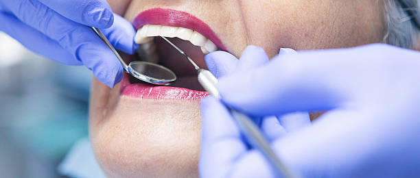 Best Emergency Dental Services for Seniors in Buchanan, GA